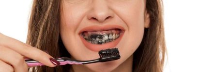 تحذير من فرك الأسنان بالفحم بغرض تبييضها